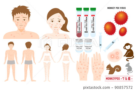 Monkeypox virus test vaccine Facial and whole body case set 90857572