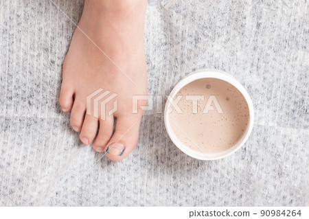 A woman's foot with an ingrown toenail on the thumb, reinforced with a titanium thread clamp and a jar of silicone. Top view. The concept of podology and orthopedics A woman's foot with an ingrown toenail on the thumb, reinforced with a titanium thread clamp and a jar of silicone. Top view. The concept of podology and orthopedics 90984264