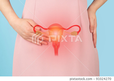 Woman suffering from pelvic pain with uterus and ovaries anatomy. Cause of pain inclued dysmenorrhea, edometriosis, PCOS, PMS, STDs, gynecologic cancer. Reproductive system and woman health problems. 91024270