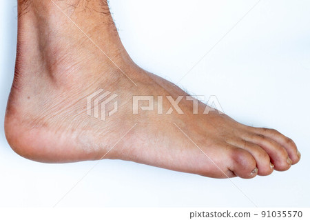 Toes, hands and nails. Male human body parts 20 to 30 years old Toes, hands and nails. Male human body parts 20 to 30 years old 91035570