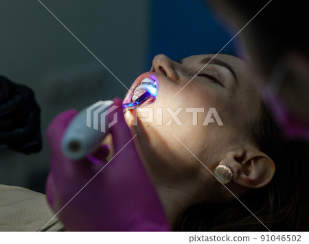 Installing a retainer after wearing braces. The process of removing braces.Beautiful woman in dental chair during procedure of installing braces to upper and lower teeth. Dentist and assistant working 91046502