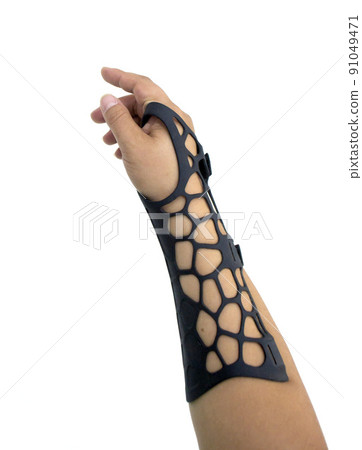 Orthopedic plastic prosthesis printed on powder 3D printer on hand isolated on white background. Gypsum close-up. Multi Jet Fusion MJF 3D printing technology. Modern progressive additive technology. Orthopedic plastic prosthesis printed on powder 3D printer on hand isolated on white background. Gypsum close-up. Multi Jet Fusion MJF 3D printing technology. Modern progressive additive technology. 91049471
