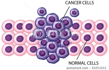 Process of cancer cell development Process of cancer cell development 91051031