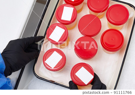 Urine analysis in the laboratory. Medical urine test. Urine sample for laboratory analysis. 91111766