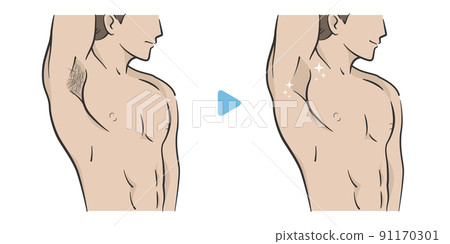 去除腋毛的男人的插圖 去除腋毛的男人的插圖 91170301