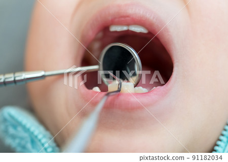 younger, tooth, baby boy 91182034