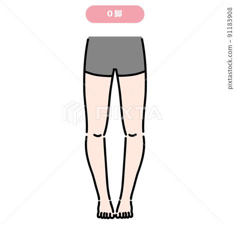 O-legged female lower body 91183908