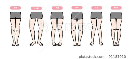 一組需要正畸的女性腿 一組需要正畸的女性腿 91183910