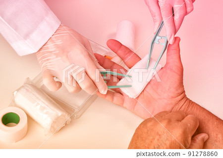 Doctor doing wound dressing care and bandaging patient's hand, Hand surgery treatment Doctor doing wound dressing care and bandaging patient's hand, Hand surgery treatment 91278860