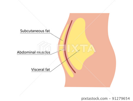 Visceral and subcutaneous fat around waistline. Location of visceral fat in abdominal cavity. Types of human obesity. Medical scheme. Vector illustration isolated on white background 91279654