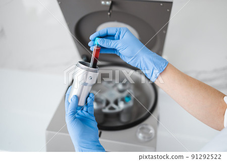 Beautician doctor's hands put test tube with blood in centrifuge container. Rejuvenation plasmolifting procedure Beautician doctor's hands put test tube with blood in centrifuge container. Rejuvenation plasmolifting procedure 91292522