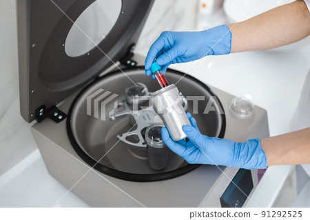 Beautician doctor's hands put test tube with blood in centrifuge container. Rejuvenation plasmolifting procedure Beautician doctor's hands put test tube with blood in centrifuge container. Rejuvenation plasmolifting procedure 91292525