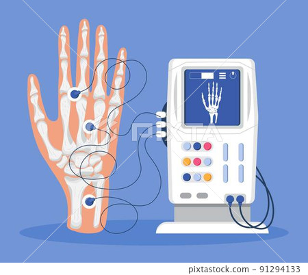 Arm, hand icon of radiography and x-ray concept vector. Phalanges of hand. 91294133