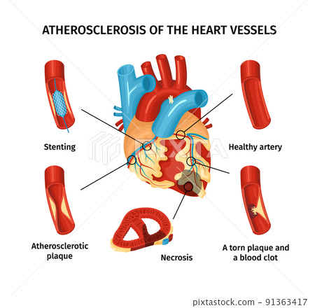 Heart Anatomy Infograpics 91363417