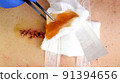 Medical sutures, stitch after surgery, stitched surgical sutures on human body smeared betadine. 91394656