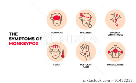 The symptoms of Monkeypox virus infographic vector. 91432232