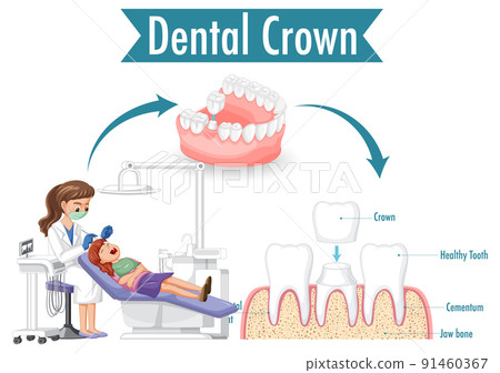 Infographic of human in dental crown on white bacground 91460367