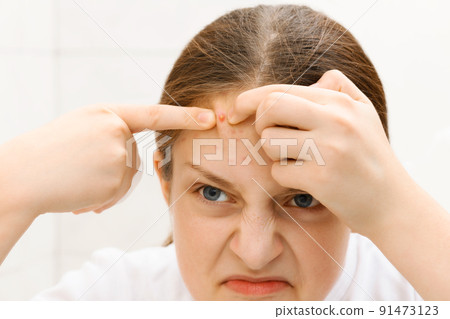 portrait of a teenage girl - she removes pimples from her forehead, touches her face, acne on the skin, concept of beauty and health 91473123