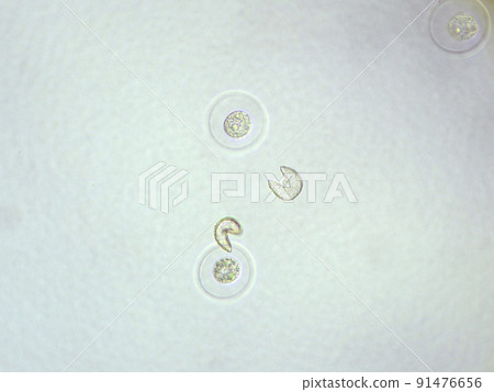 Micrograph of cedar pollen 1 (400x) 91476656