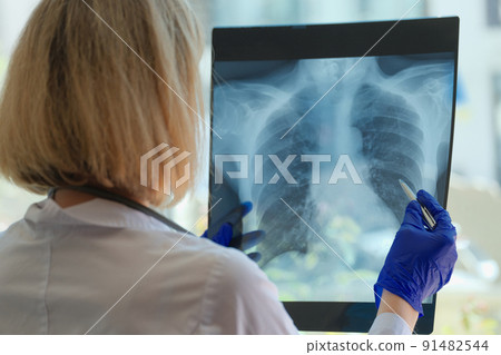 Doctor examines chest x-ray of patient in hospital Doctor examines chest x-ray of patient in hospital 91482544