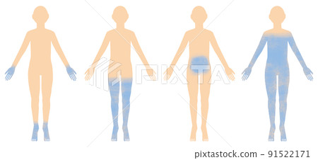 Person_4 按類型劃分的冷敏感性 91522171