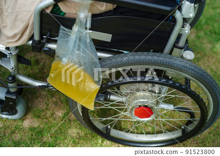 Asian disability woman with urine bag on wheelchair. Asian disability woman with urine bag on wheelchair. 91523800