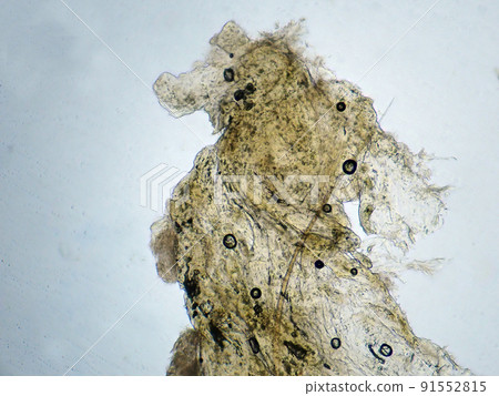 Micrograph of human earwax (100x) Micrograph of human earwax (100x) 91552815