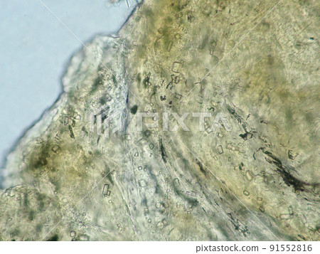 Micrograph of human earwax (400x) Micrograph of human earwax (400x) 91552816