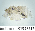 Micrograph of human finger epidermis (100x) 91552817