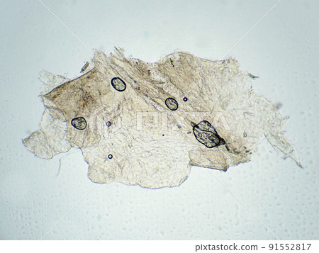 人手指表皮顯微照片 (100x) 人手指表皮顯微照片 (100x) 91552817