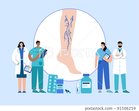 Varicose veins treatment Varicose veins treatment 91586259
