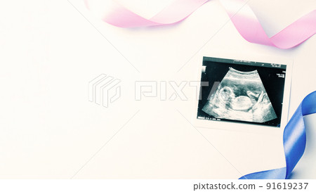 Ultrasound photo pregnancy baby. Blue, pink ribbon with ultrasound pregnancy picture on white background. Concept maternity, pregnancy, childbirth. 91619237