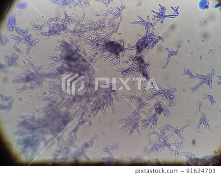 Mold collected by the window is a phytopathogen Mold collected by the window is a phytopathogen 91624703