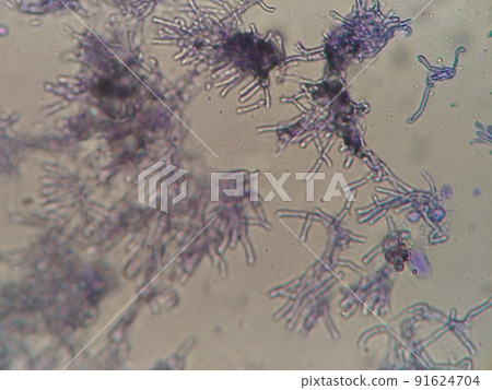 Micrographs of various black molds Micrographs of various black molds 91624704