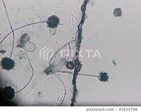 How the mucor is growing How the mucor is growing 91624706