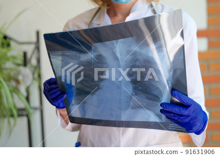 Doctor holding x-ray photograph of lungs in hands Doctor holding x-ray photograph of lungs in hands 91631906