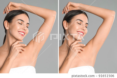 Collage of woman showing armpit before and after epilation on light grey background 91651506