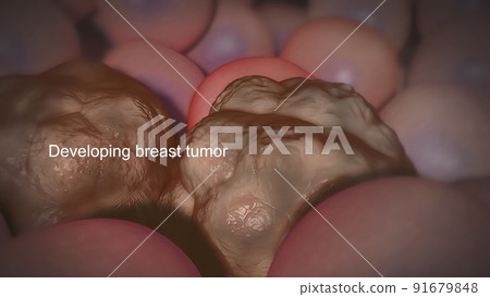 Cancer begins when genetic changes interfere with this orderly process. Cancer begins when genetic changes interfere with this orderly process. 91679848