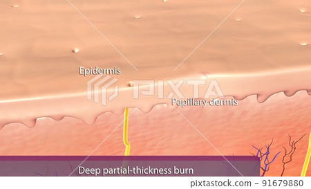 Epidermis of thin skin. From the depth to the surface it can be identified the the basale, spinosum, granulosum and corneum strata. Epidermis of thin skin. From the depth to the surface it can be identified the the basale, spinosum, granulosum and corneum strata. 91679880