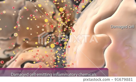 Inflammation is the standard, initial response of the body to injury 91679881