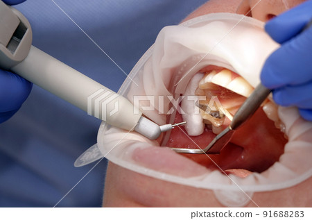 Doctor dentist working with a patient 91688283