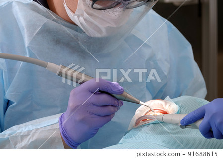 doctor dentist working with a patient shot close-up 91688615