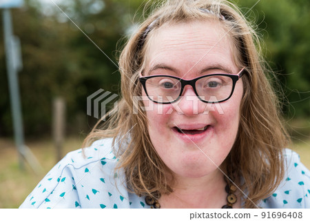 Portrait of a cute 38 year old girl with Down Syndrome, 91696408