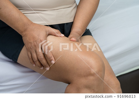 Asian lady woman patient touch and feel pain her knee, healthy medical concept. Asian lady woman patient touch and feel pain her knee, healthy medical concept. 91696813