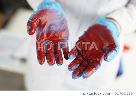 Surgeon in blue gloves with blood closeup 91701156