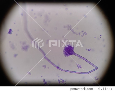長菌絲根黴 長菌絲根黴 91711825