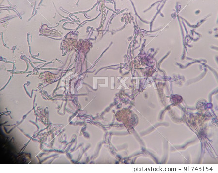 A state in which short hyphae are entwined A state in which short hyphae are entwined 91743154