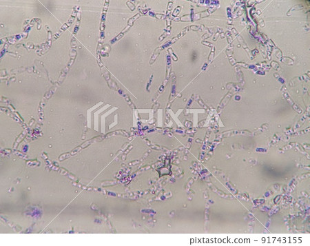 Mycelial cells are breaking down 91743155