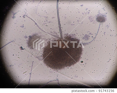 根霉的大孢子 91743156