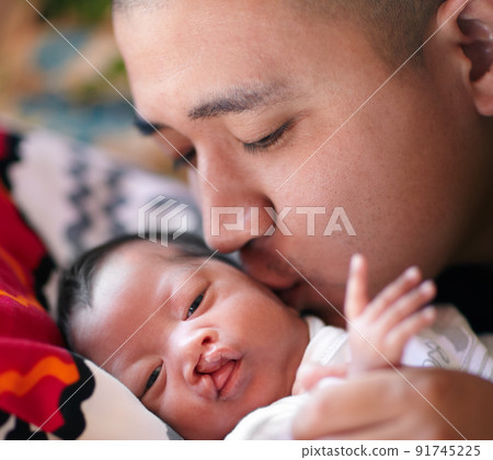 The loving kiss of a father. Shot of a young father giving his baby girl who has a cleft palate a kiss on the cheek. 91745225
